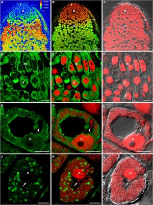 The Regulation of Pea (Pisum sativum L.) Symbiotic Nodule Infection and Defense Responses by Glutathione, Homoglutathione, and Their Ratio